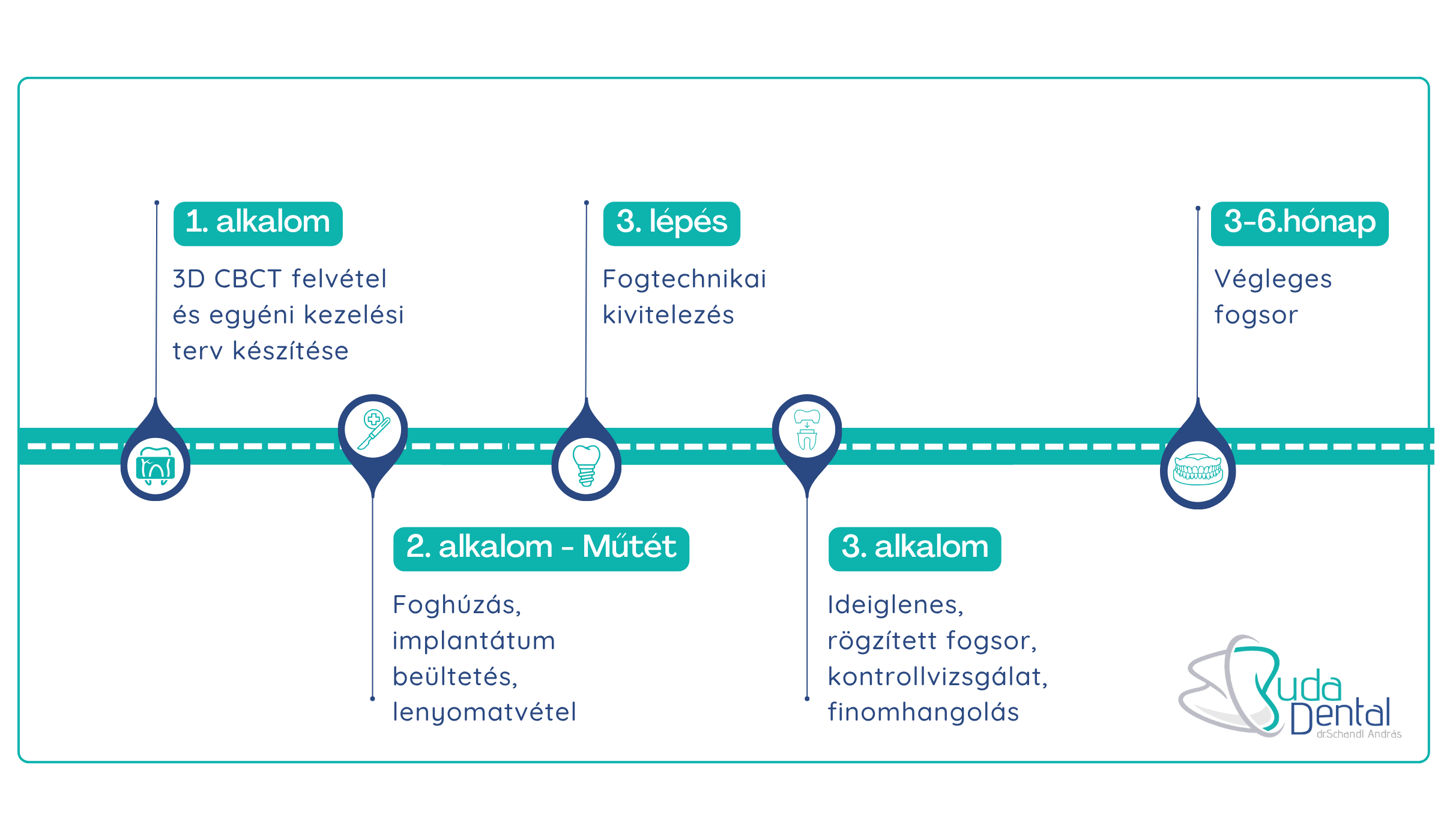 teljes-foghiany-kezelesenek-lepesei Teljes foghiány kezelésének lépései