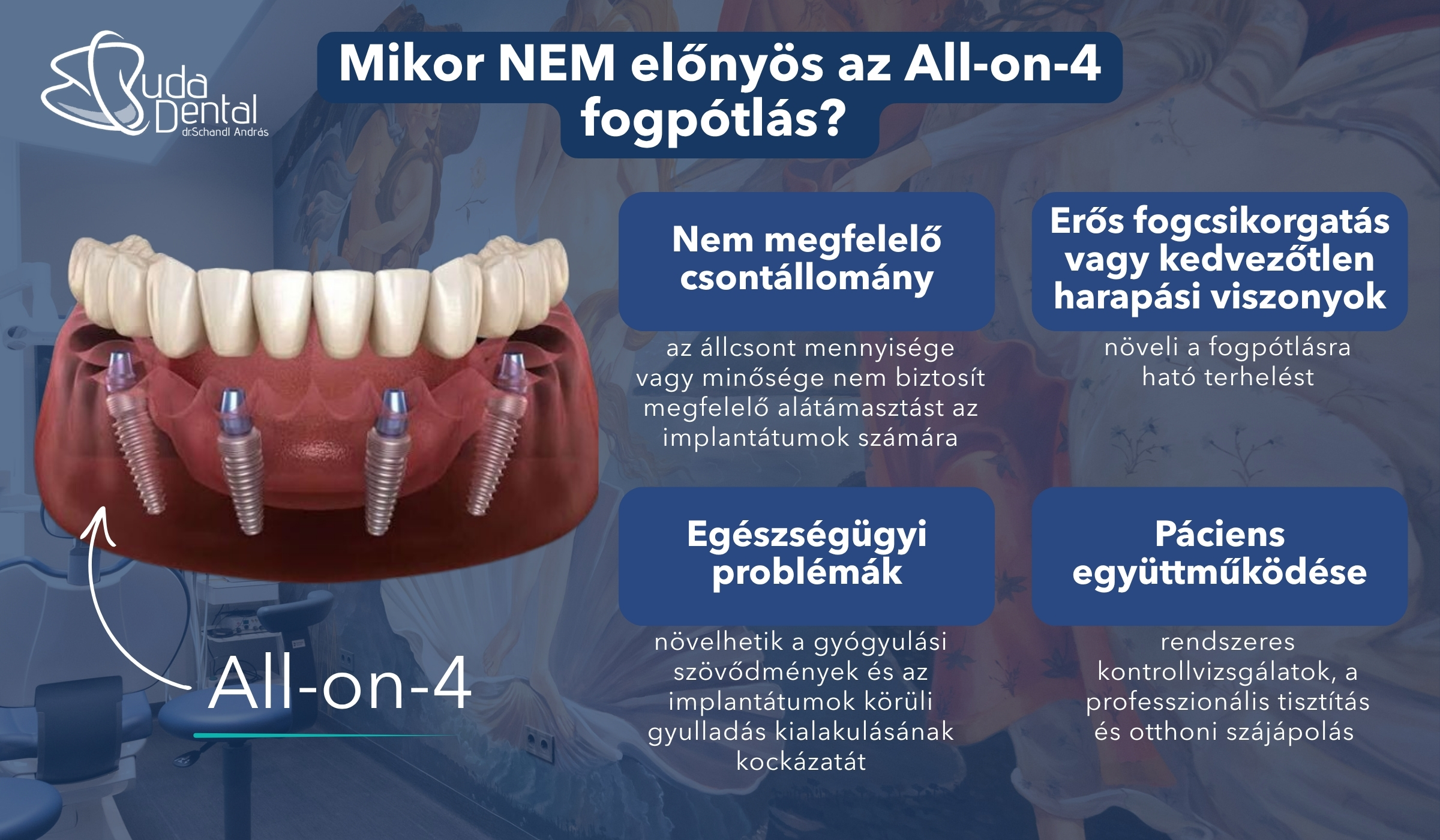 Mikor NEM előnyös az All-on-4 fogpótlás Mikor NEM előnyös az All-on-4 fogpótlás?