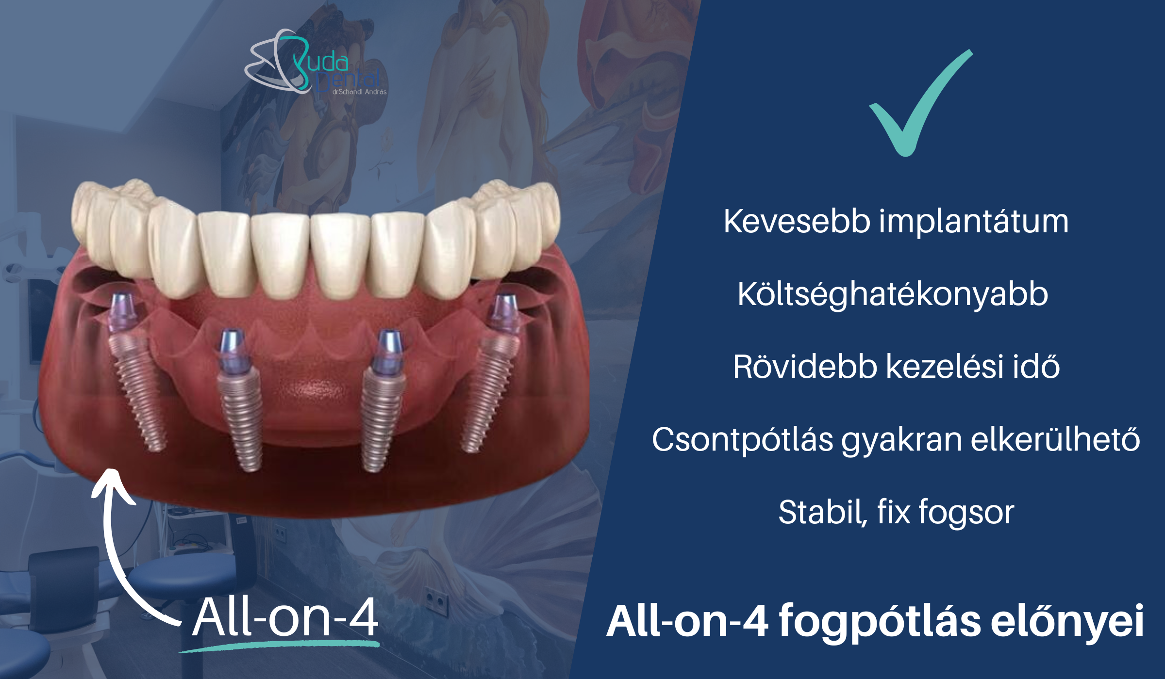 buda-dental-cikk-20-fogpotlas-szorongo-pacienseknek-kep-02 All-on-4 dental implants infographic showing advantages (fewer implants, cost savings, shorter treatment time) with a dental model on the left and Hungarian bullet points on the right.